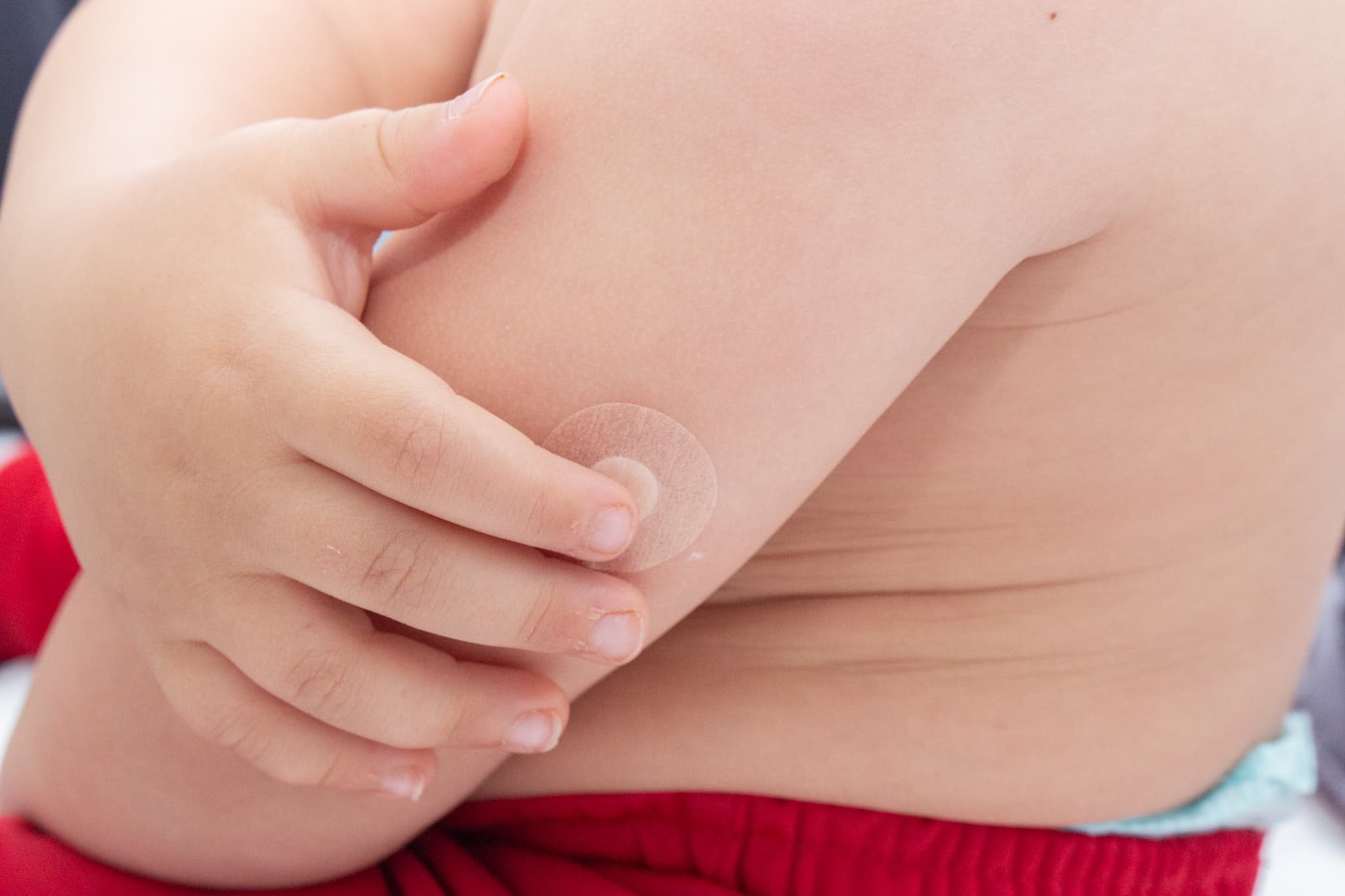 Criança com um curativo de vacina no braço.